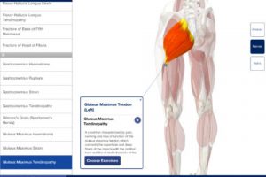 Rehabilitation for Lower Limbs for iPad